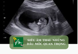 Siêu âm thai: Những dấu mốc quan trọng