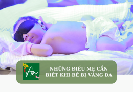 Những điều mẹ cần biết khi bé bị vàng da