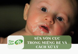 Sữa vón cục trong miệng bé và cách xử lý